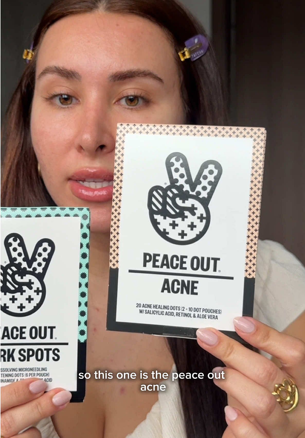 Honest thoughts on this acne care brand