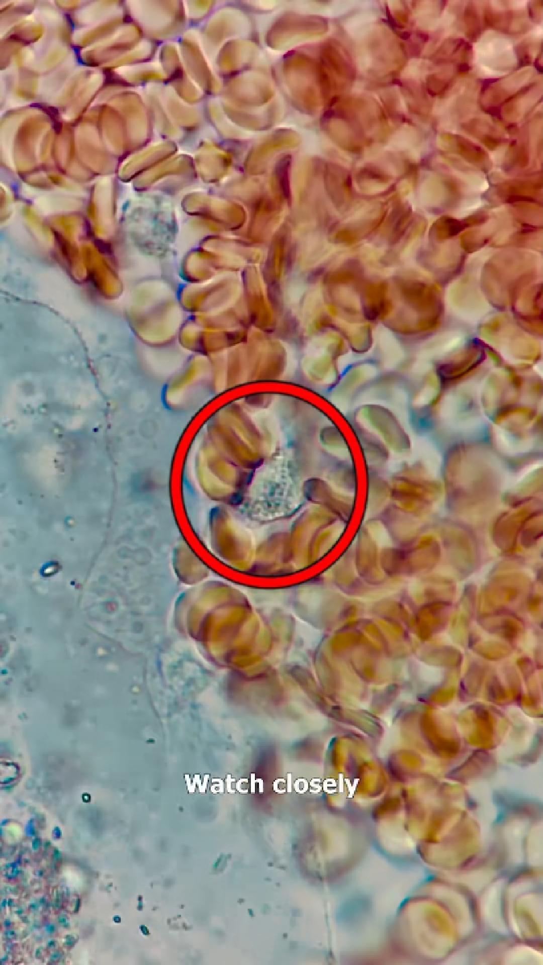 Still water vs immune system under the microscope: What you don’t see ...