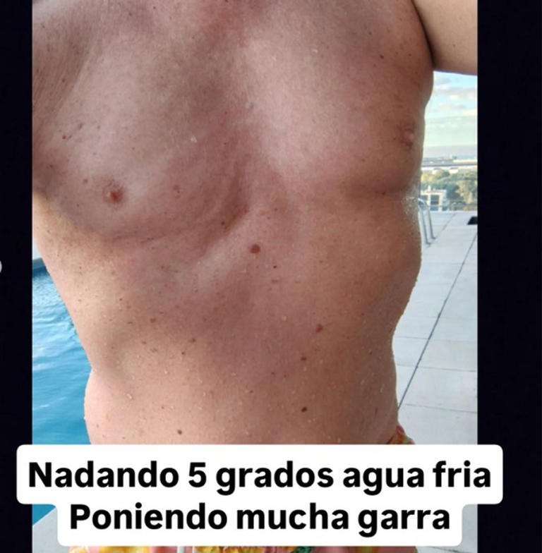 Las impactantes fotos de Leandro Rud y su valiente mensaje en su lucha ...