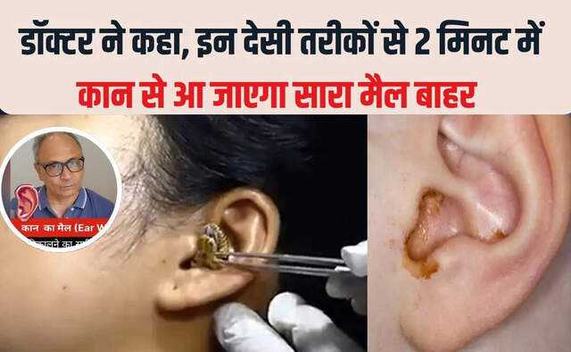 Effective home remedies for ear wax removal