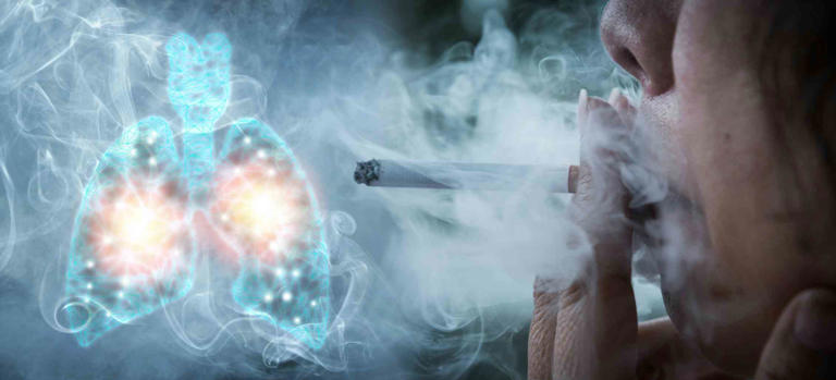 Chronic obstructive pulmonary disease develops over decades – and we ...