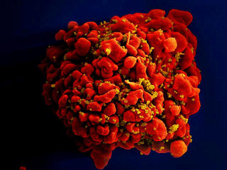 Small study shows one-time cell therapy can control HIV infection