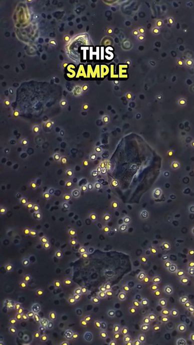 What menstrual blood looks like under a microscope will surprise you