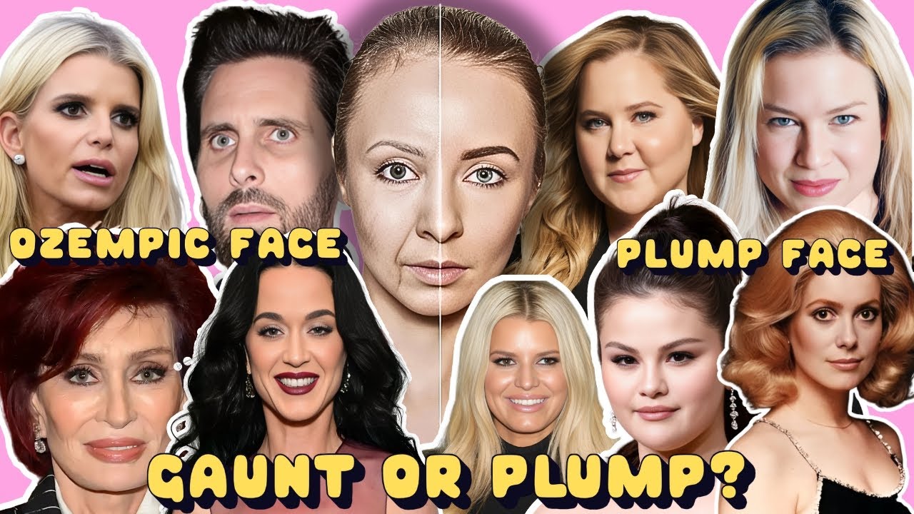 Ozempic Face Or A Plump Face The Beauty Dilemma