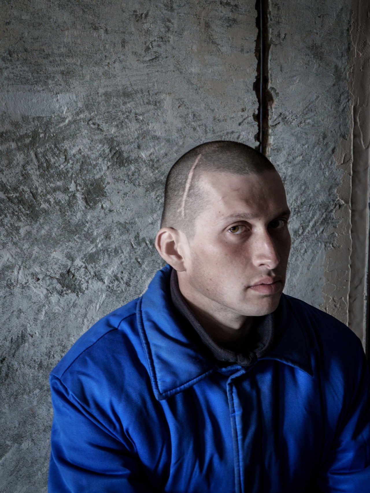 He was missing part of his arm. Russia sent him into battle anyway.