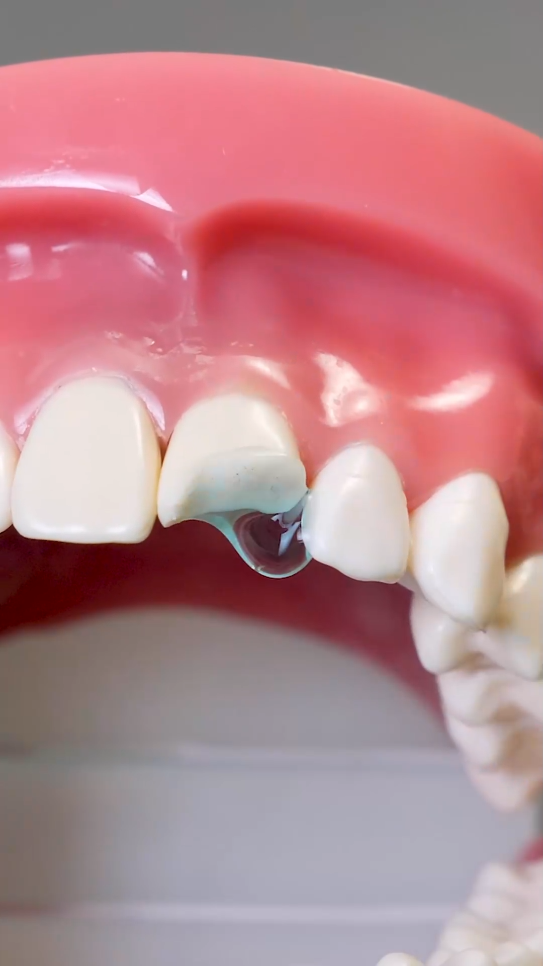 Repairing a chipped tooth: The expert touch you need