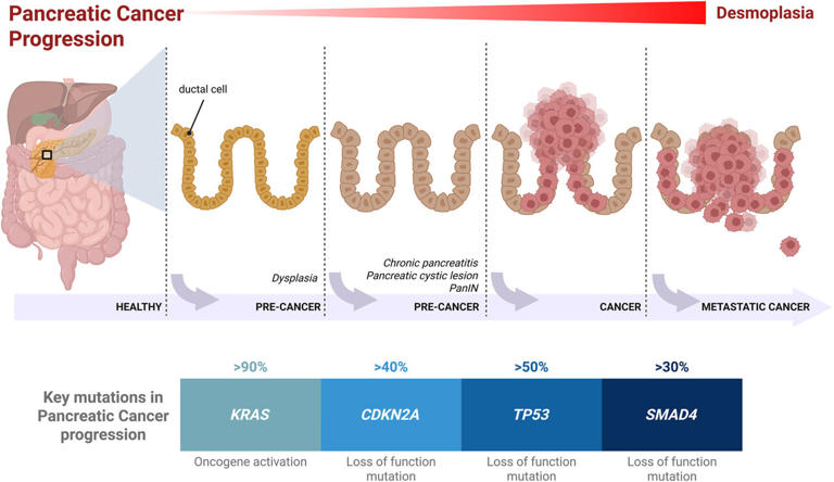 Pancreatic cancer 'playbook' reveals why survival remains just 13% ...
