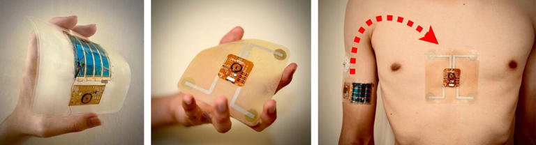 Battery-free skin-conformal wearable system can measure ...