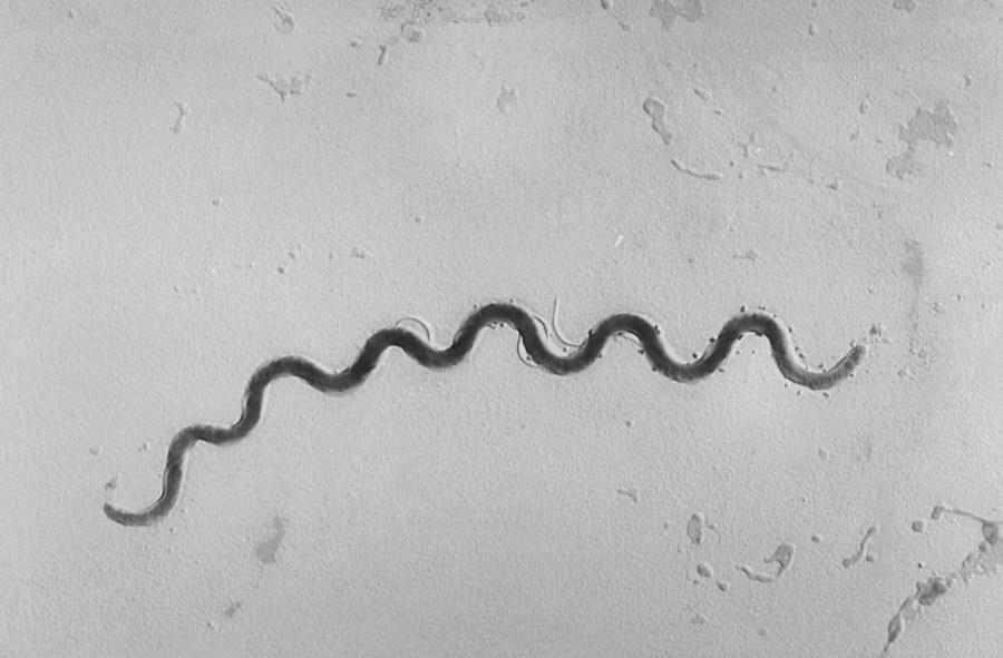 Syphilis making a comeback, health officials warn. CDC map shows where ...