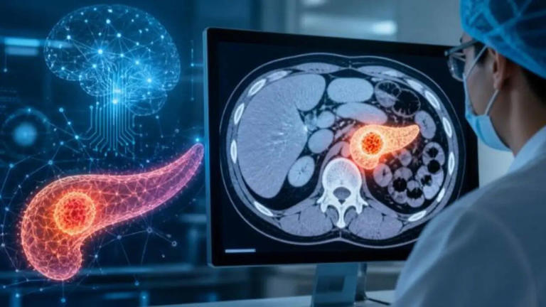 AI breakthrough could detect pancreatic cancer 3 years early, before ...