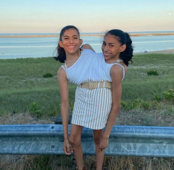 Conjoined twins share biggest worry after doctor's 'crushing' prognosis