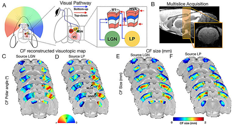 Ultrafast MRI uncovers brain signal direction: New scan may help decode ...