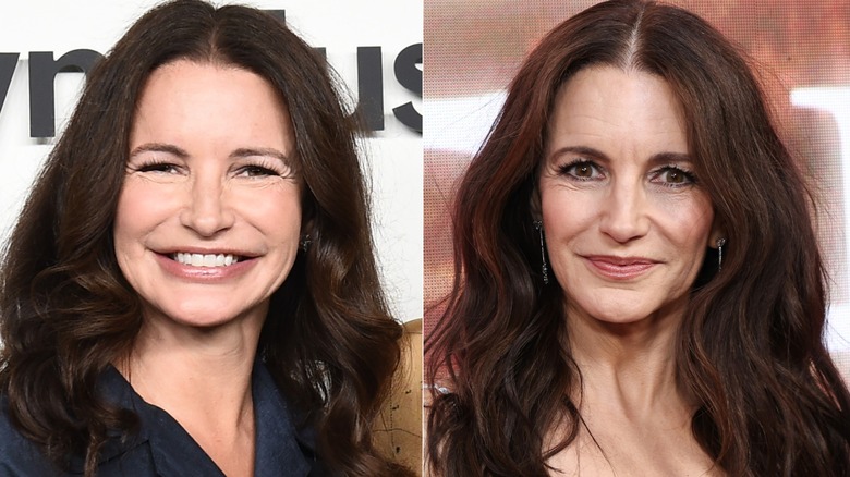 Side-by-side pics of celebs who dissolved their filler for health reasons