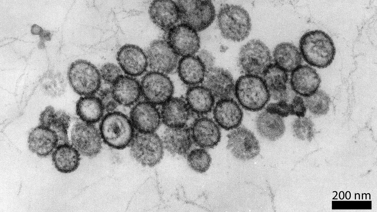 3 dead, dozens monitored as virus hits cruise ship