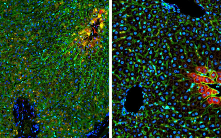 In world first, Israeli scientists map digital atlas of healthy human liver