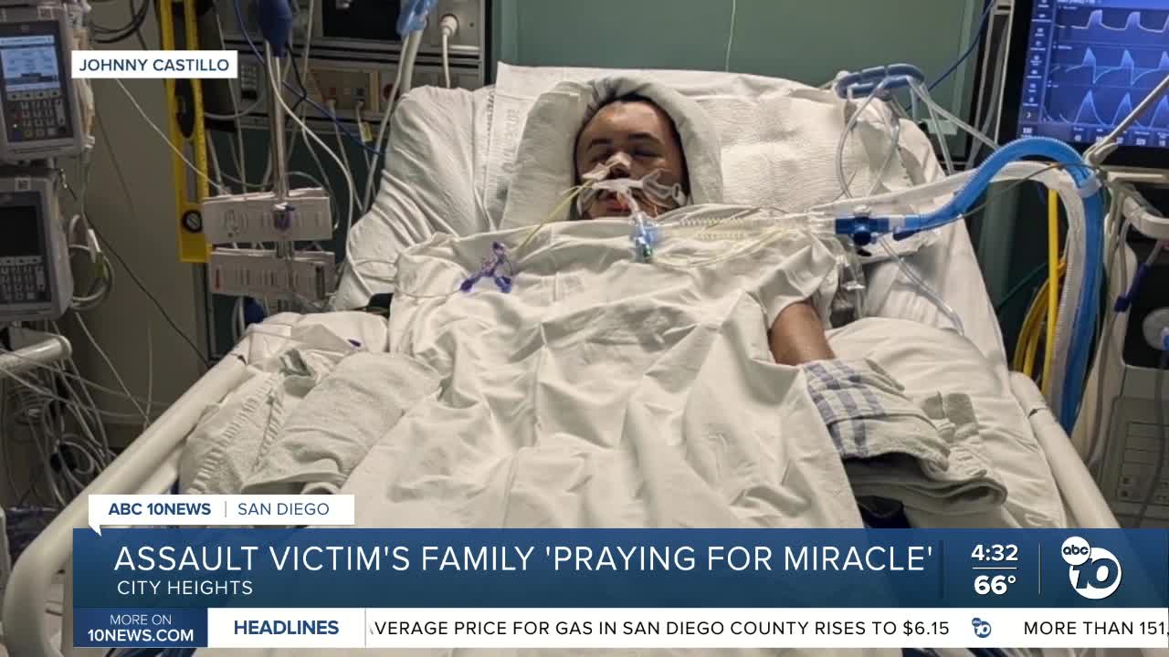 Man brutally attacked by 'known transient', left with severe brain damage