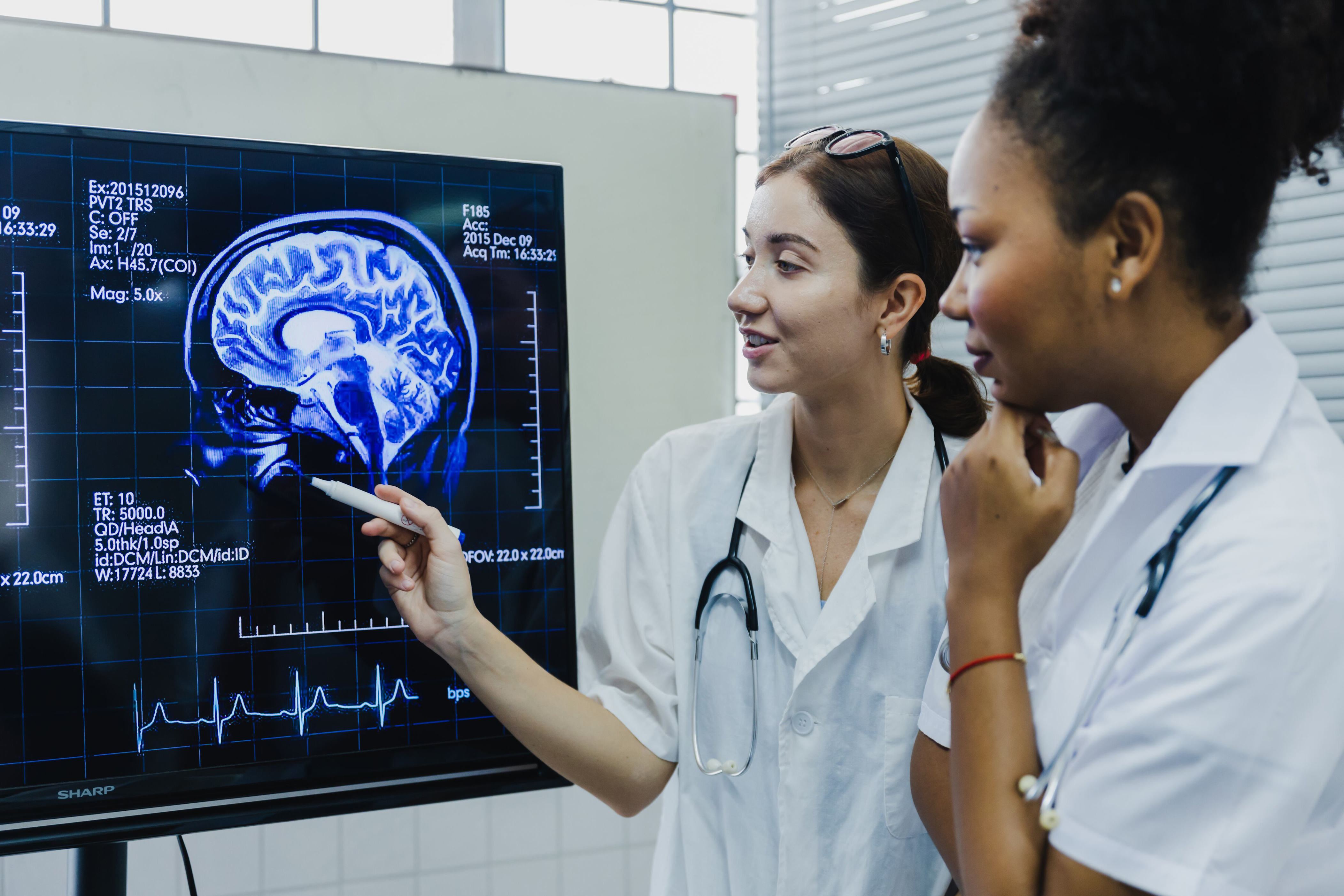 Accidente cerebrovascular: lo que debes observar para actuar a tiempo