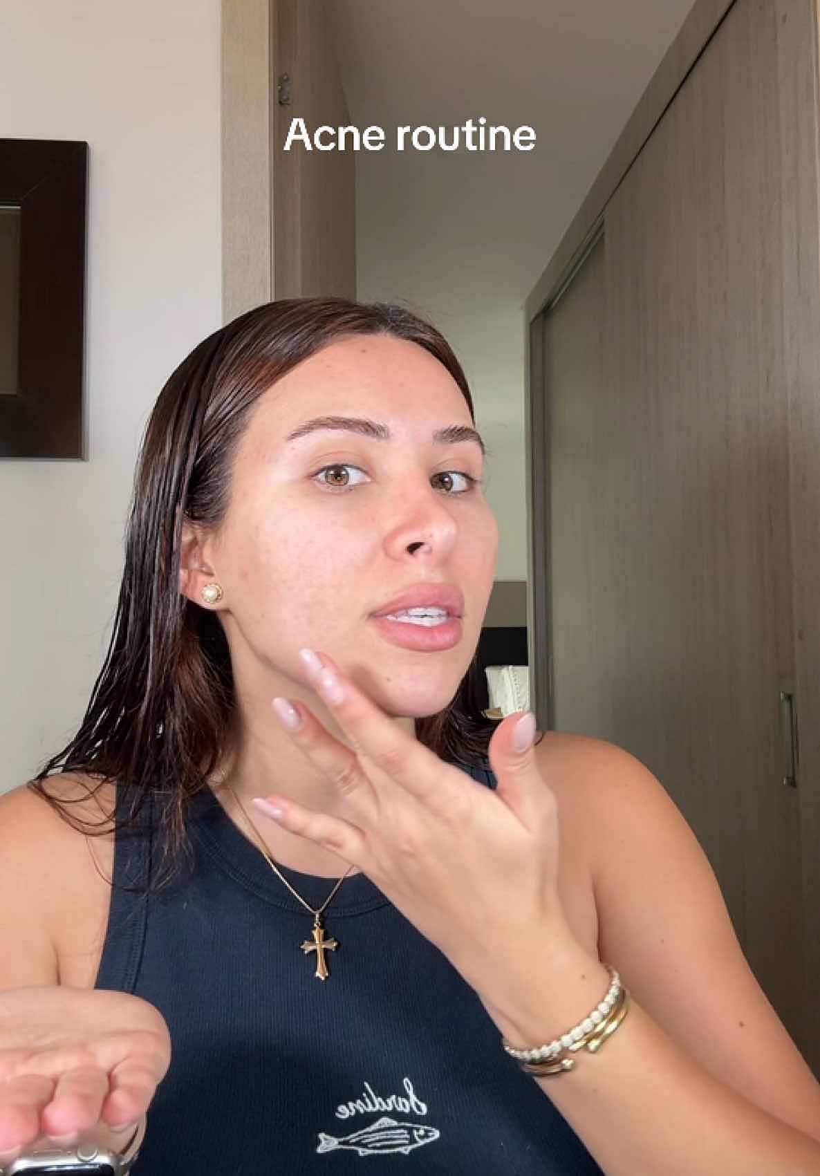 Acne Prone Skin Quick Skincare Hack That Works