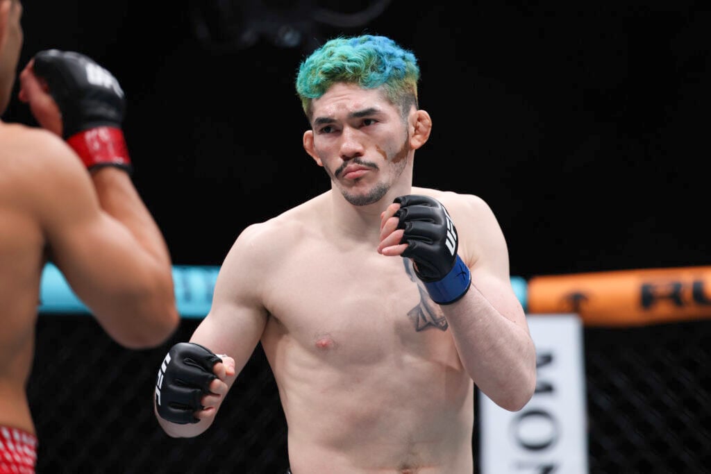 People called me racist: Melquizael Costa reveals impact of vitiligo ...