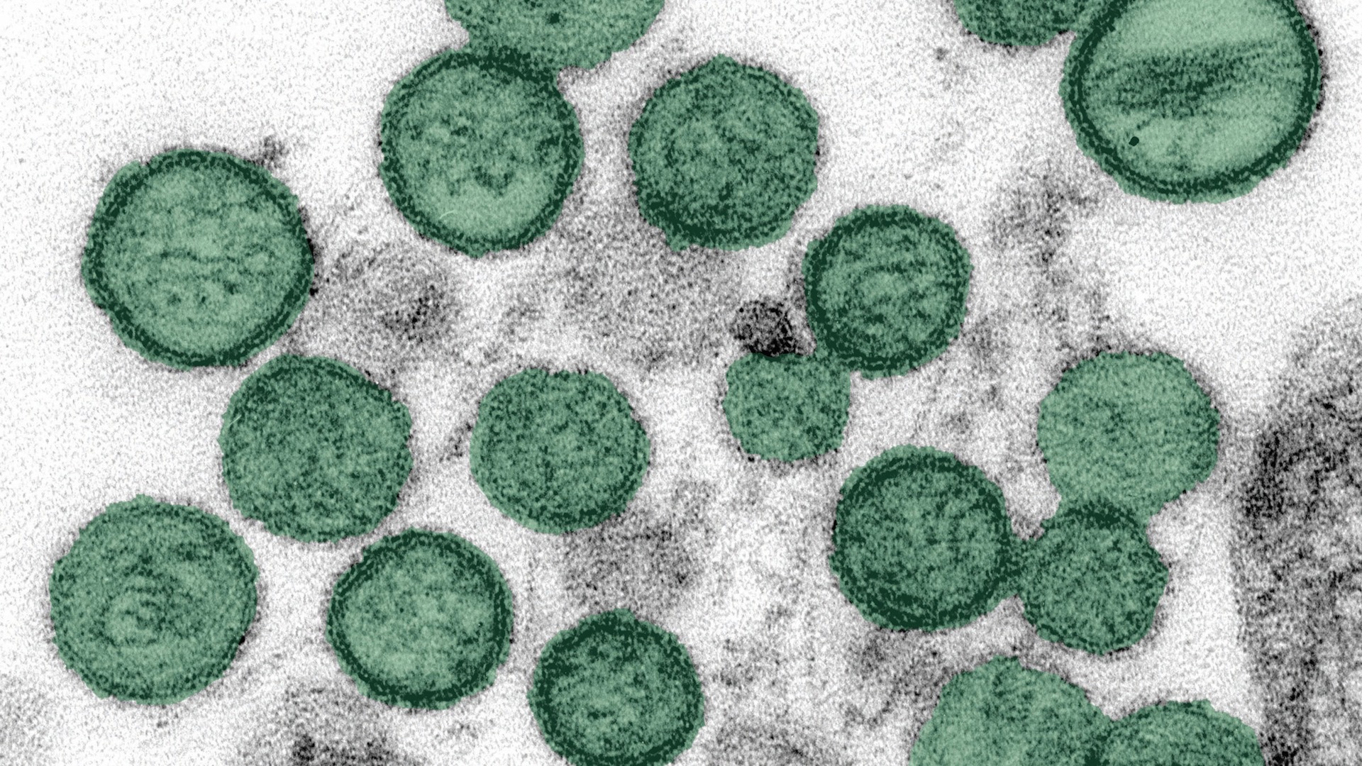 What is the hantavirus?