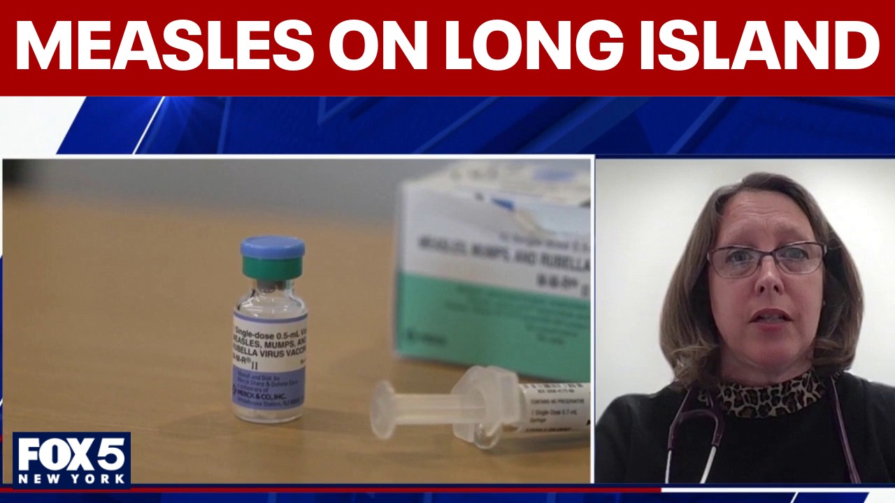 Child under 5 tests positve for Measles in Nassau County