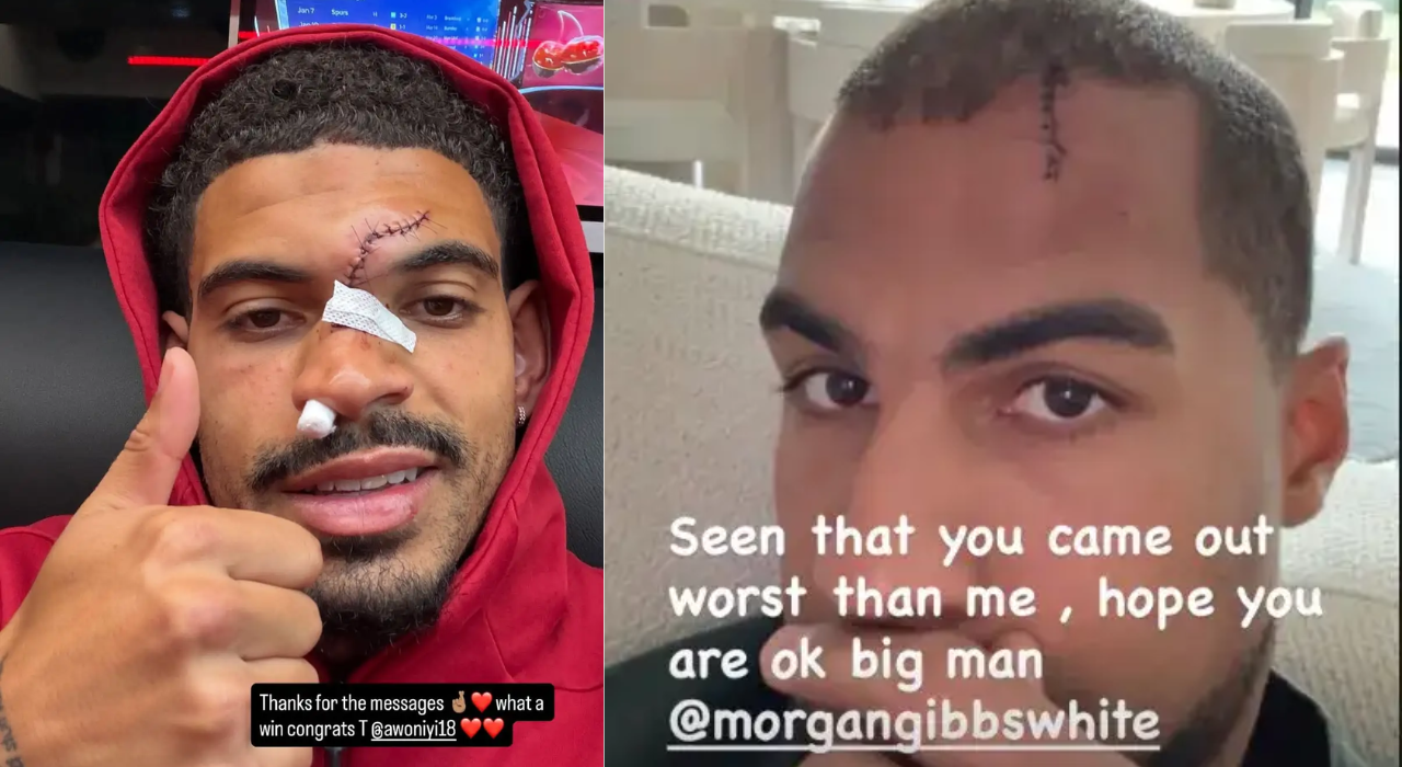 Horror on the pitch: Nottingham Forest star posts gruesome head injury ...