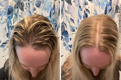 Before and after images showing improved hair volume, possibly from a hair care product. The person looks down, highlighting the hair's texture