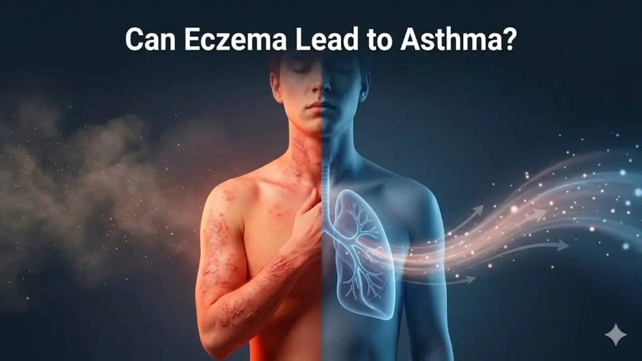 Untreated eczema could lead to chronic asthma: Dermatologist answers FAQs