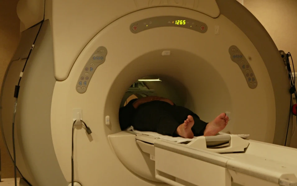 Long-term MRI study links less visceral fat to slower brain aging