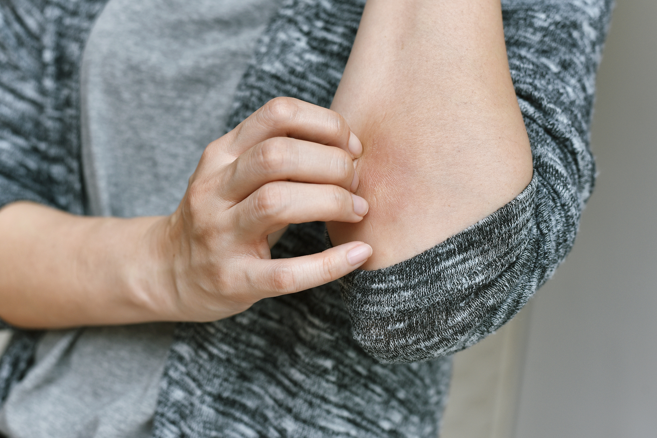 The medicine cabinet: Ask the Harvard experts: Constant redness and ...