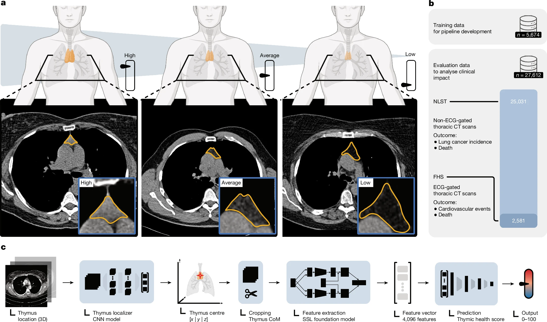 This tiny 'mysterious organ' is no useless lump. 2 global studies link ...