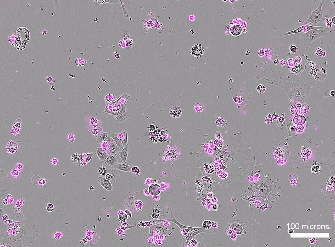 A new kind of CRISPR could treat viral infection and cancer by ...