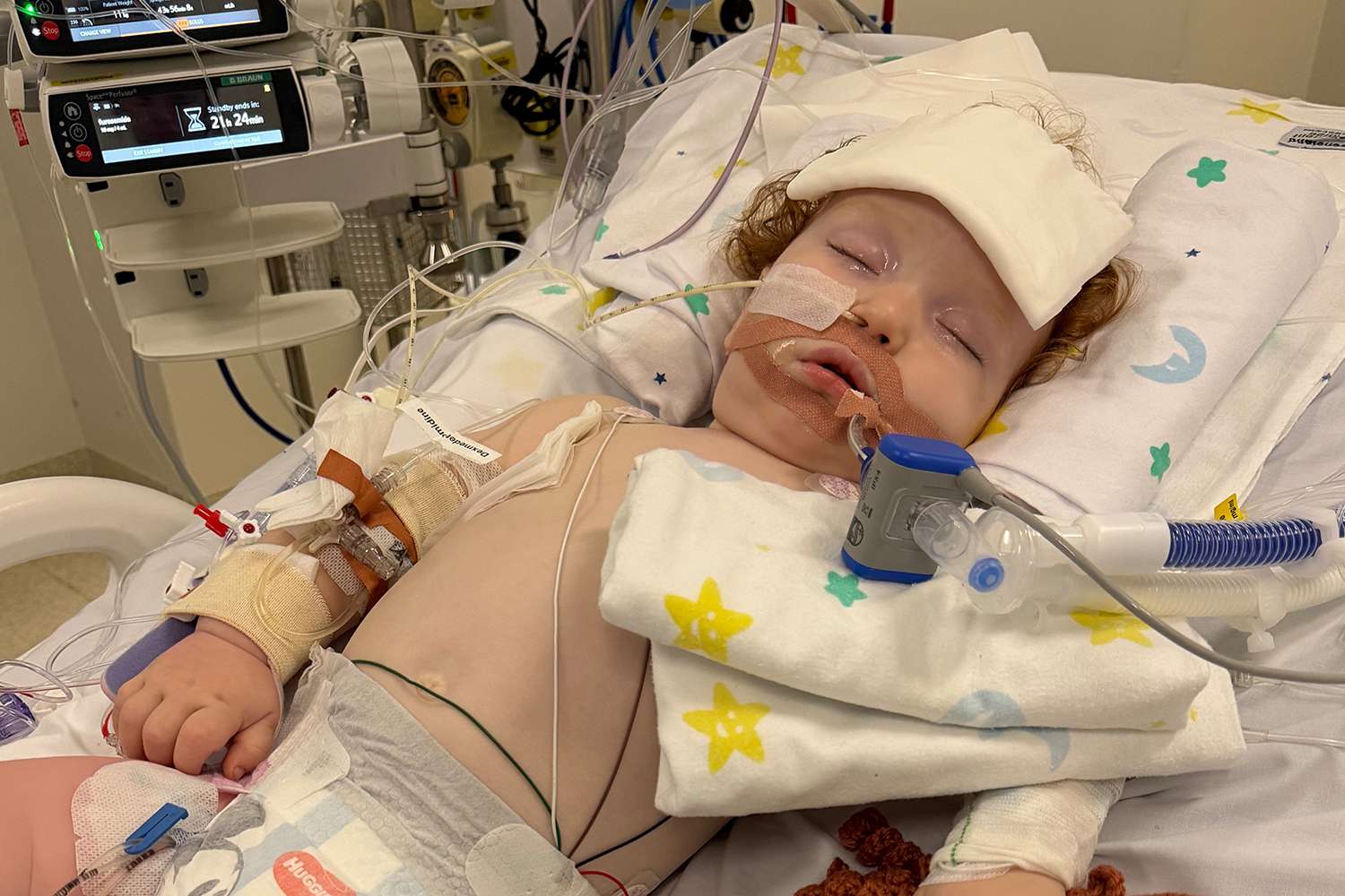 Toddler in induced coma after inhaling 'gold dust powder' while his mom ...