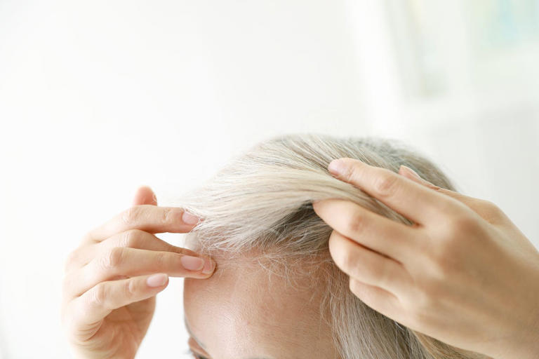 The hidden factor in hair thinning: why chronic stress causes hair loss ...