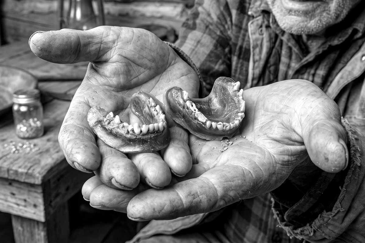 1940s miner crafted dentures from toothbrush handles and coyote teeth