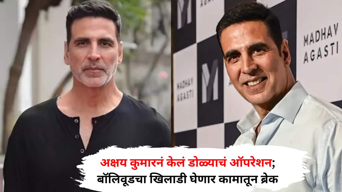 Akshay Kumar eye surgery: अक्षय कुमारनं केलं डोळ्याचं ऑपरेशन; बॉलिवूडचा ...