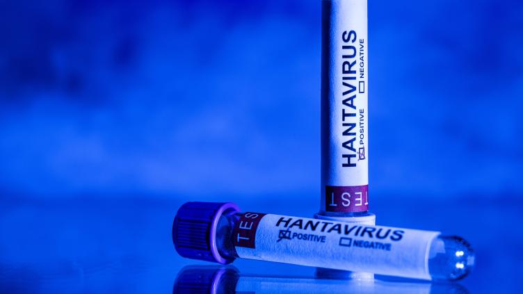 Premier cas français d’hantavirus Andes