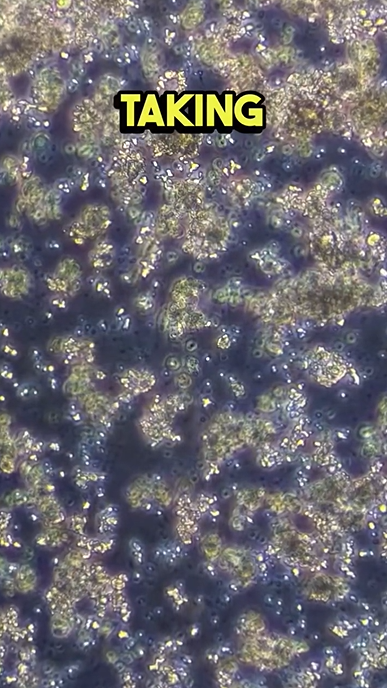 What coconut cult looks like under a microscope is fascinating