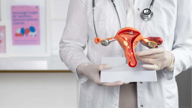 PCOS renamed as PMOS: Here's why the name changed and what it reveals ...
