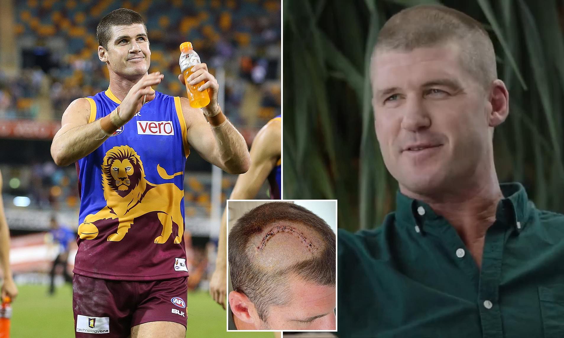 AFL icon Jonathan Brown reveals all about his cancer battle - and the ...