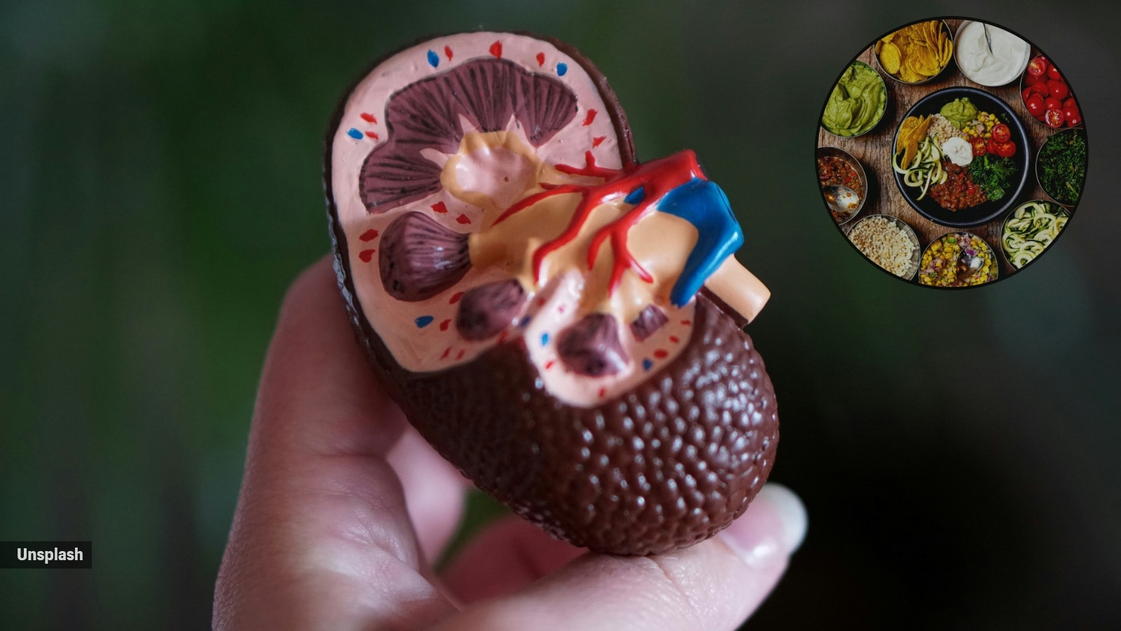 Experts warn against common diet mistakes harming kidney health - Common Kidney Problems In Syrian Hamsters