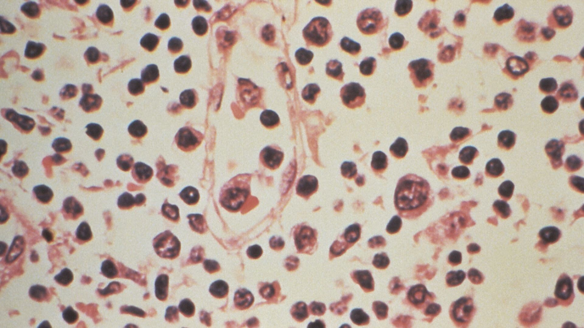 DHS: Hantavirus risk in Wisconsin is low