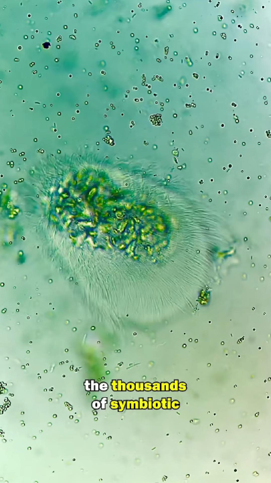 I looked at a termite’s stomach under the microscope — and what I saw ...