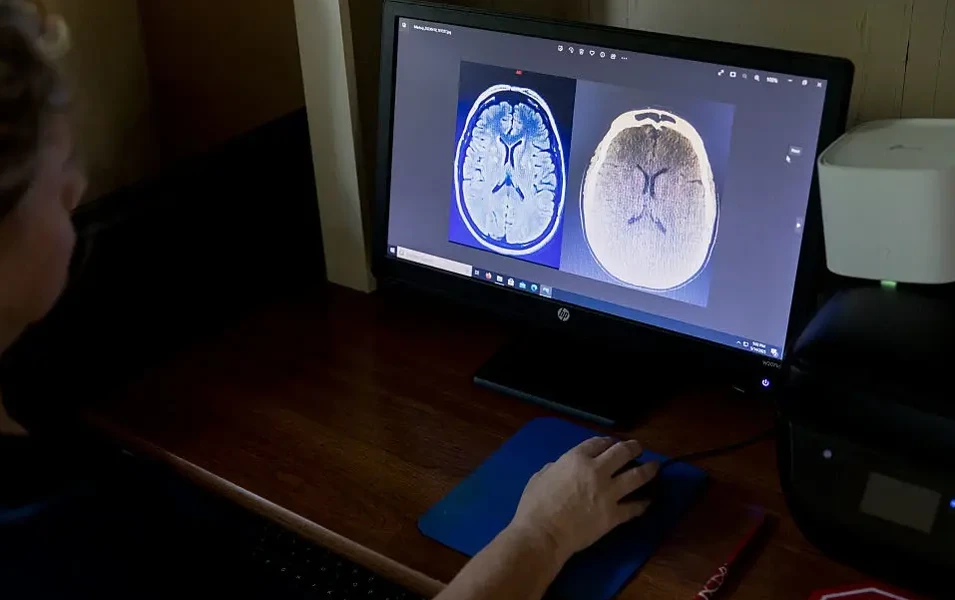 Stroke survivor’s journey highlights urgency of early action
