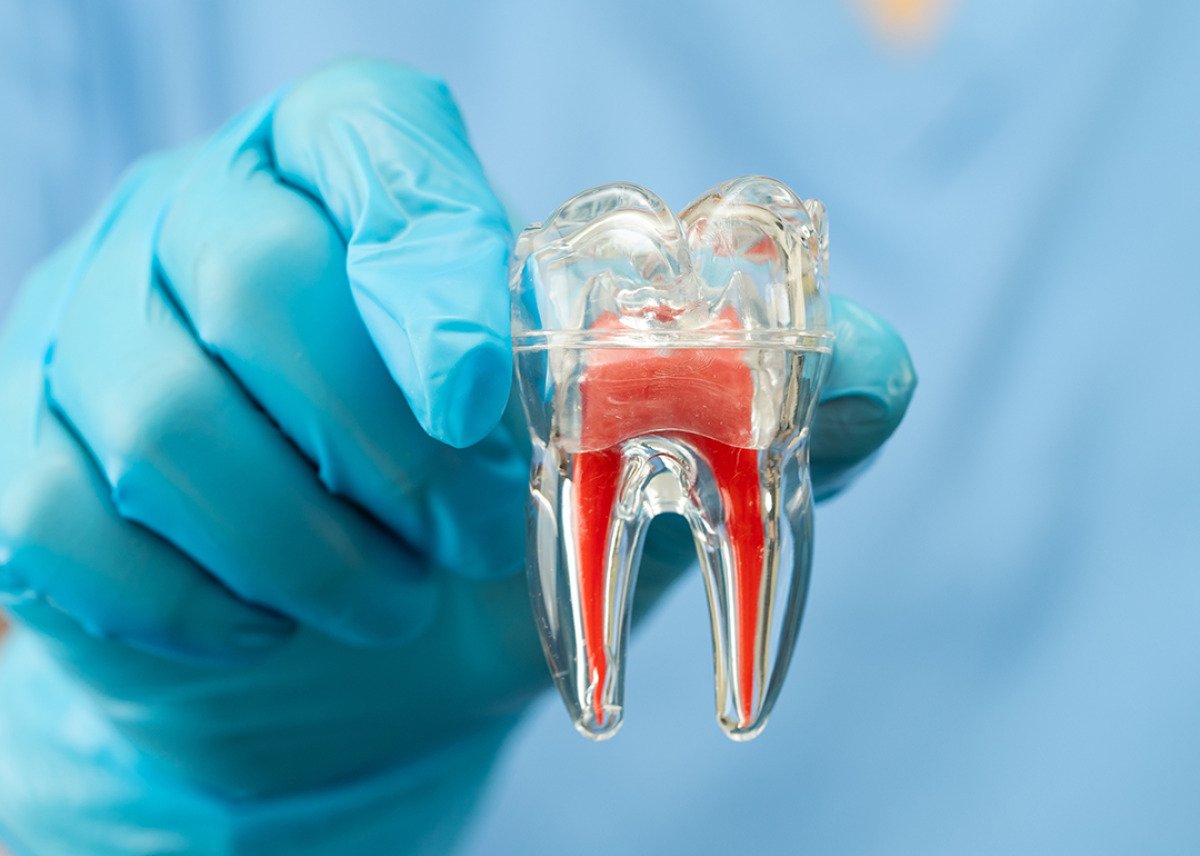 You have 30 minutes to save a knocked-out tooth. Only 27% of US adults ...