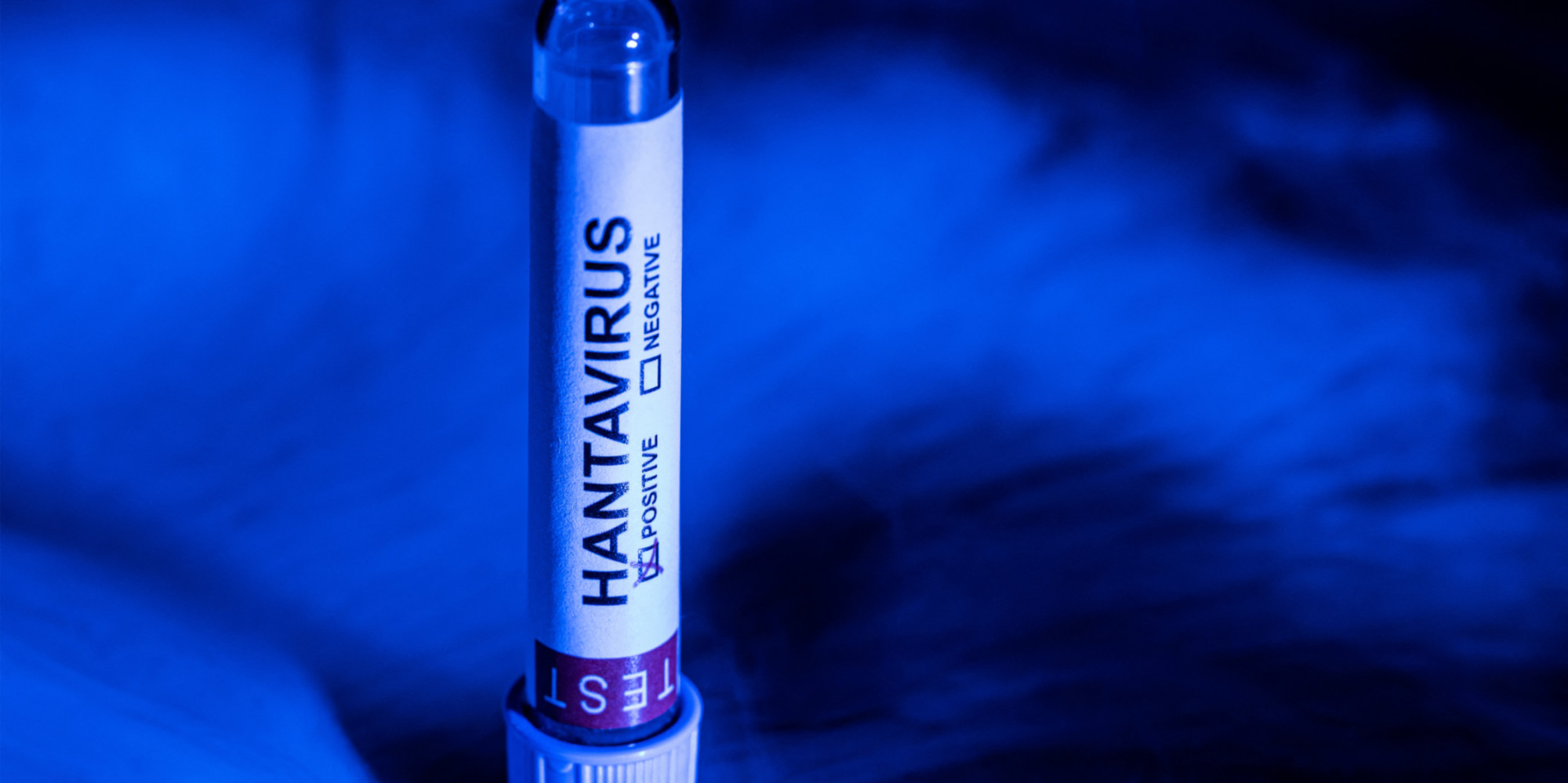 Hantavirus : les résultats des cas contacts français toujours attendus
