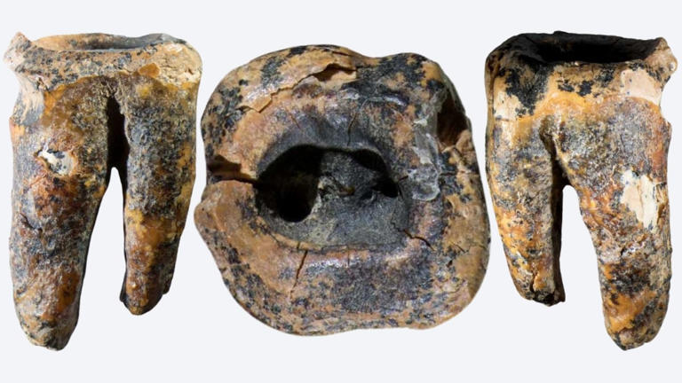 The earliest known dentistry wasn't done by our species