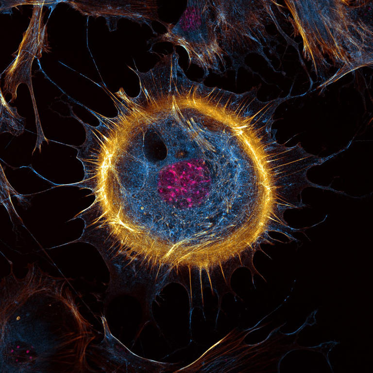 See 17 intricate microscope photographs that make the miniature world ...