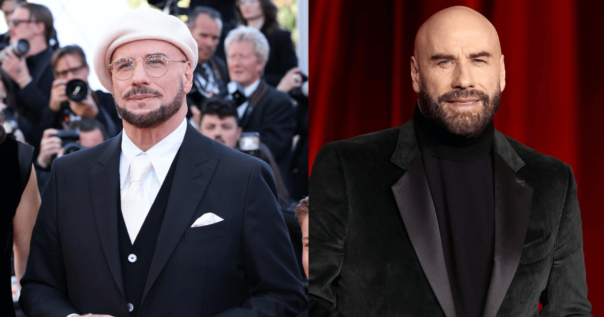 did john travolta have plastic surgery Image 2