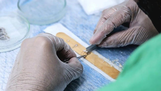 Scientists are growing hair in labs and it could change hair loss ...